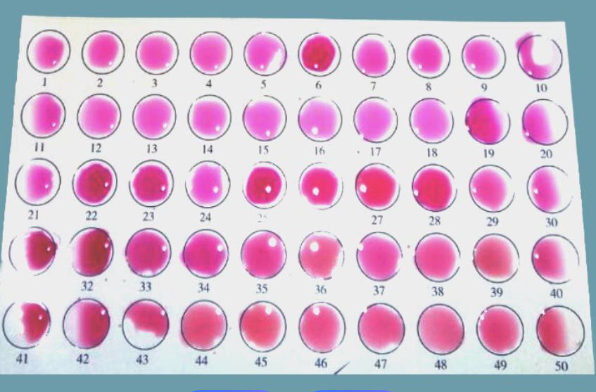 布氏菌病虎红平板凝集试验抗原
